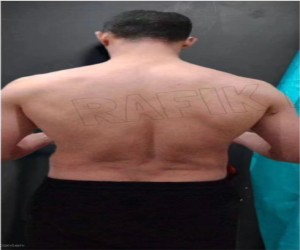 Before transformation